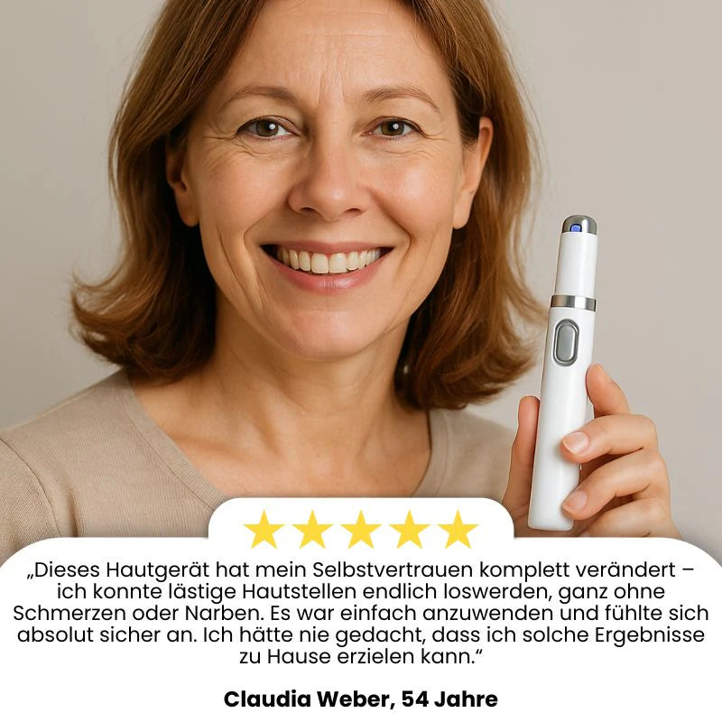 LaserPen™ | Präziser Plasma-Hautkorrektor