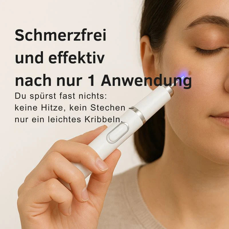 LaserPen™ | Präziser Plasma-Hautkorrektor