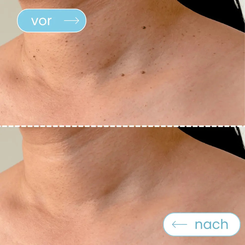 Biokur TagFrei™ Komplett-Set