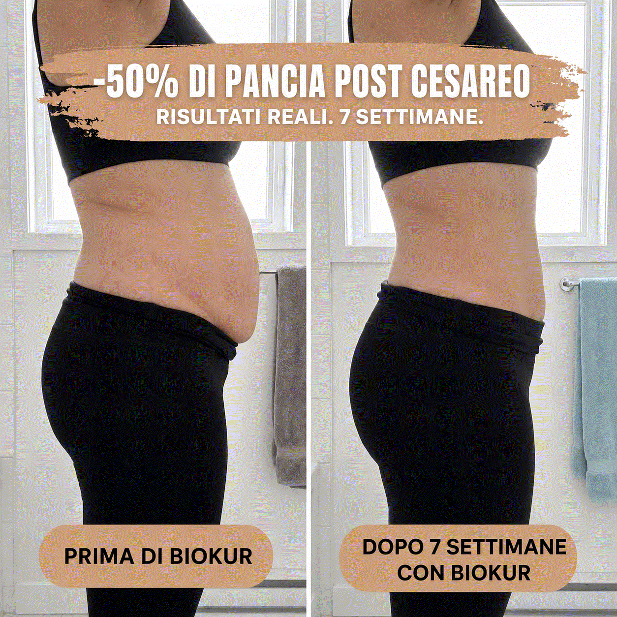 Culotte Post-Partum — Compressione a 360°