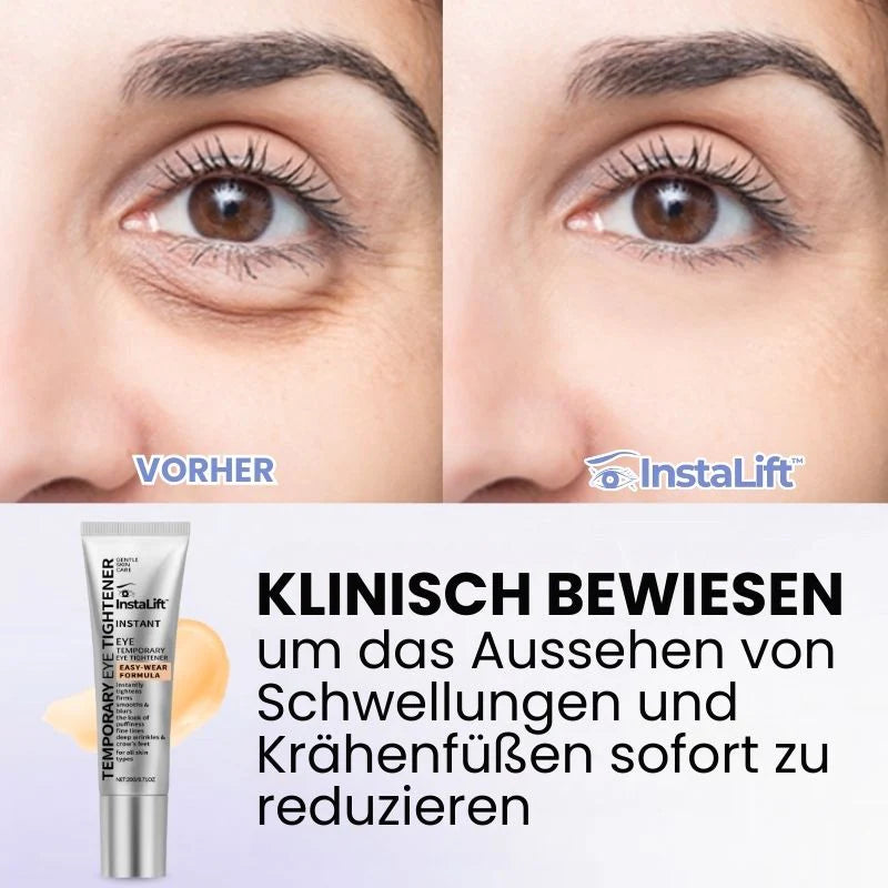 InstaLift™ | Temporärer Sofort-Straffer