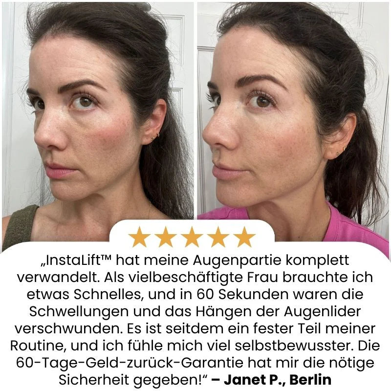 InstaLift™ | Temporärer Sofort-Straffer