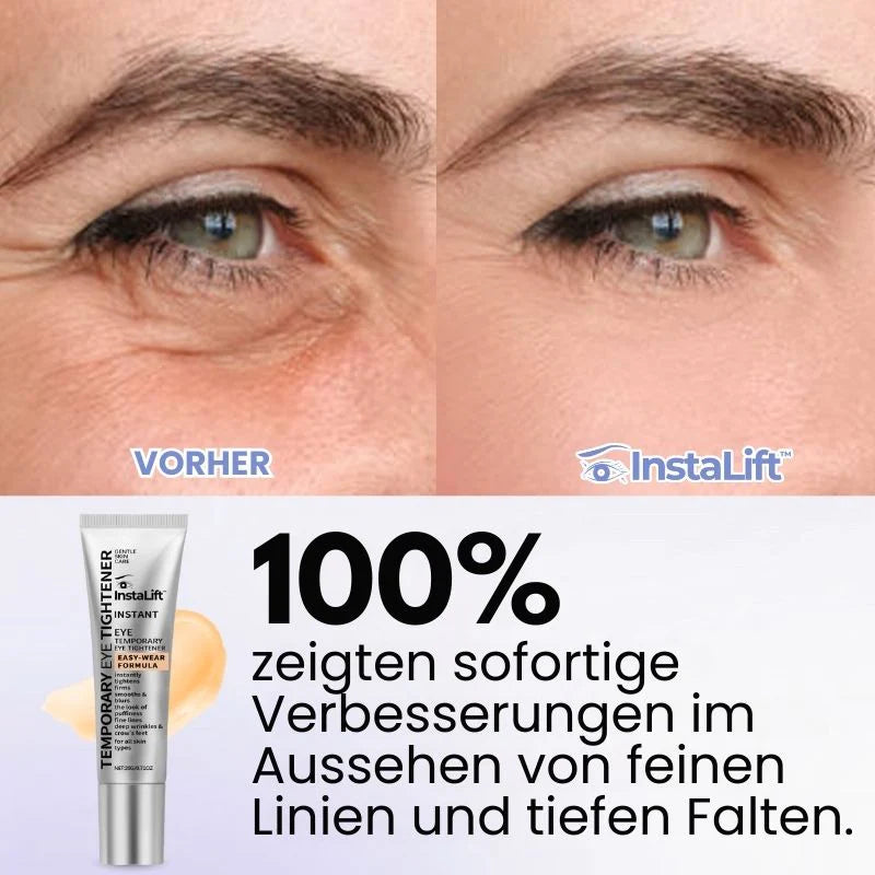 InstaLift™ | Temporärer Sofort-Straffer