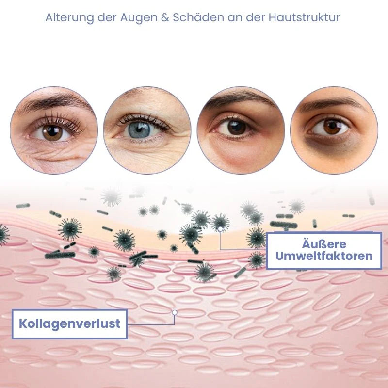 InstaLift™ | Temporärer Sofort-Straffer