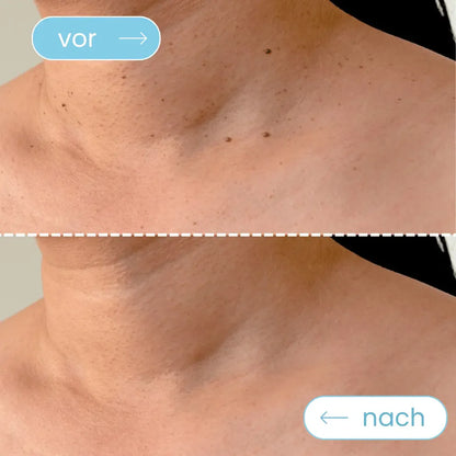 Biokur TagFrei™ Komplett-Set